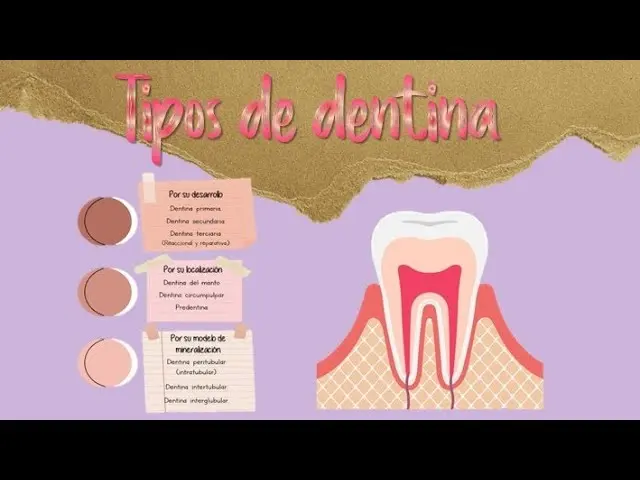 dentina terciaria gomez de ferraris - Cuál es la dentina terciaria