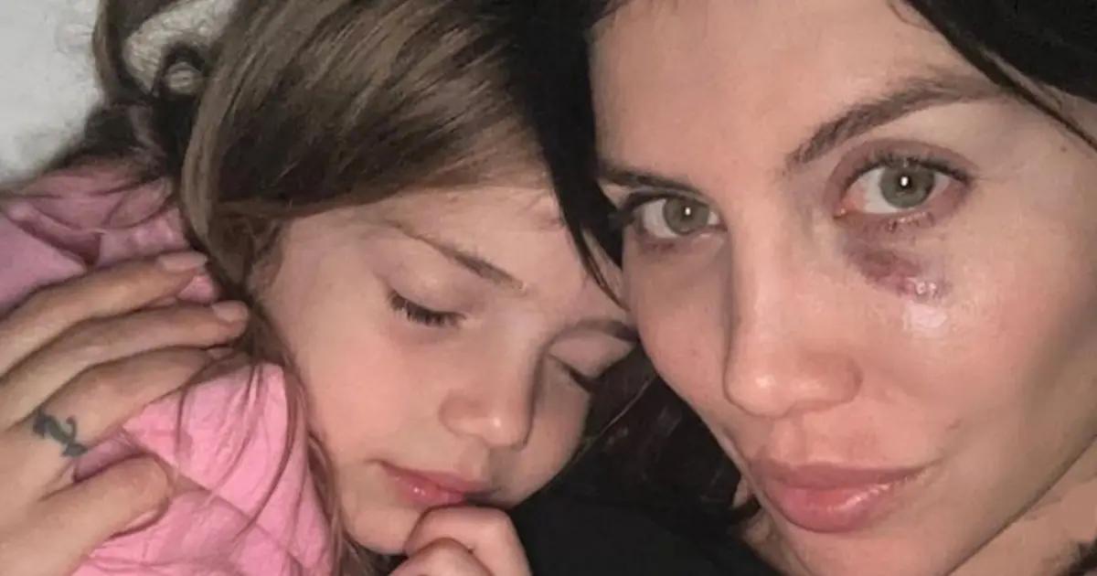 ferrari de wanda nara - Qué le pasó a la cara de Wanda Nara
